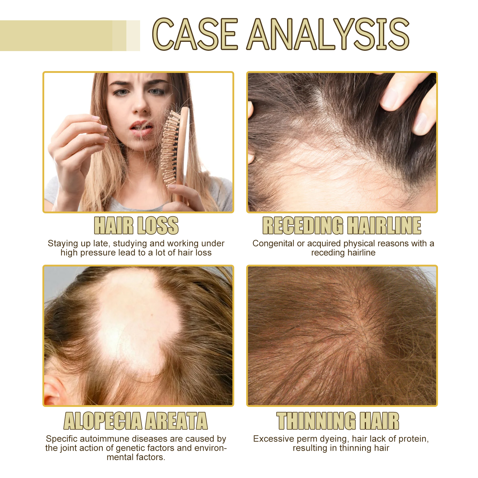 60ml Rosemary Hair Oil for Thi - Hair Care Treatment ulasan dan harga