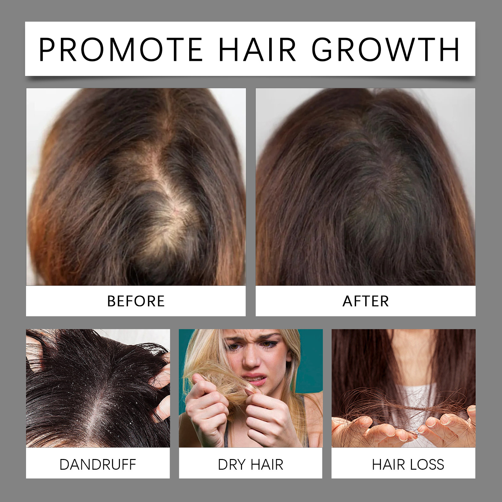 30ml Hair Care Essential Oil T - Hair Care Treatment ulasan dan harga