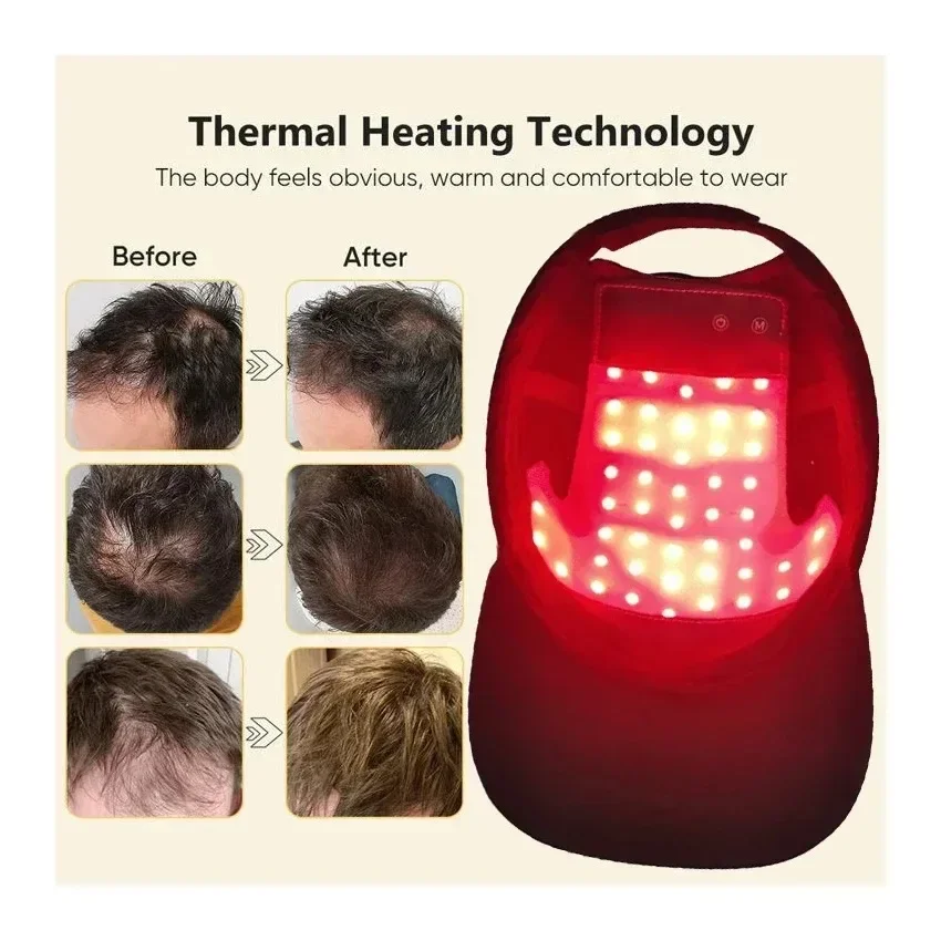 NEW LED Red Blue Light Therapy - Hair Care Nutrition ulasan dan harga