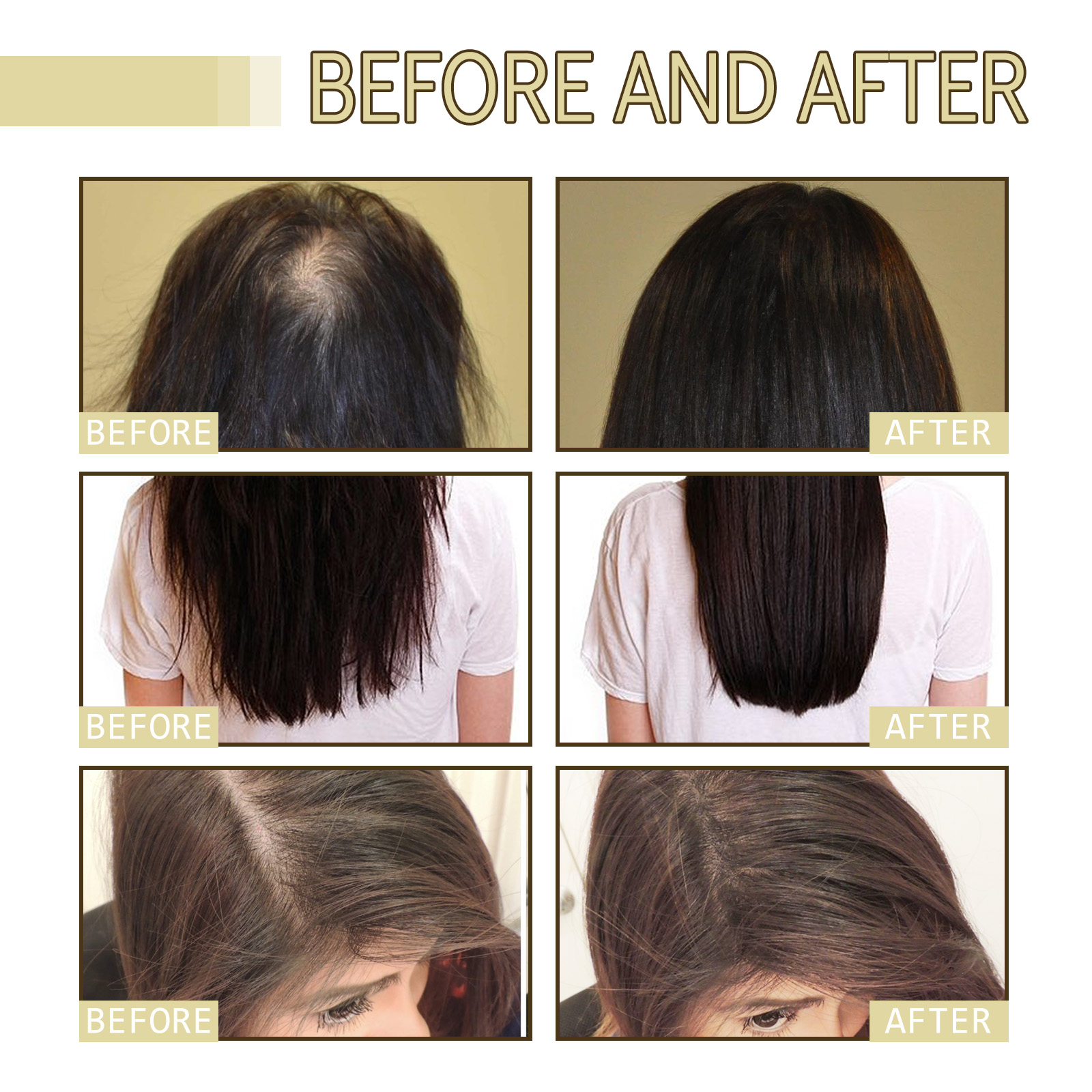 Rosemary Hair Growth Oil 60ml  - Hair Care For Hair Loss ulasan dan harga