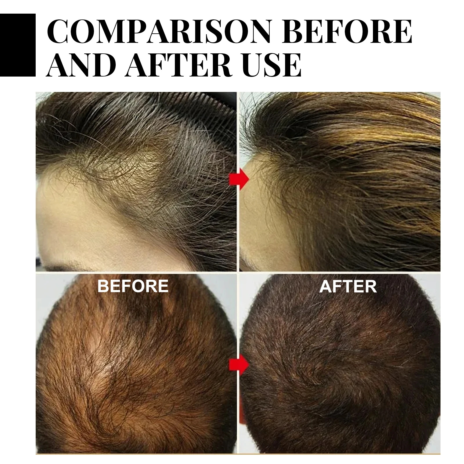 Fast Ginger Hair Growth Spray  - Hair Care For Hair Loss ulasan dan harga