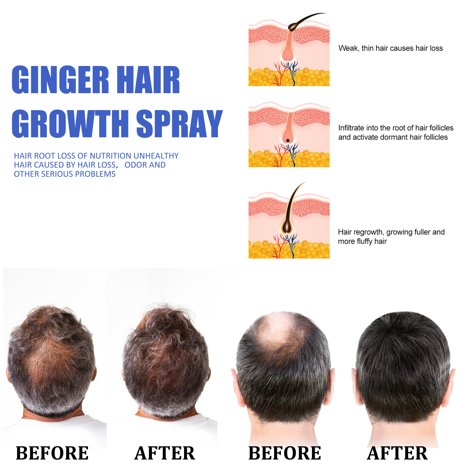 Fast Ginger Hair Growth Spray  - Hair Care For Hair Loss ulasan dan harga