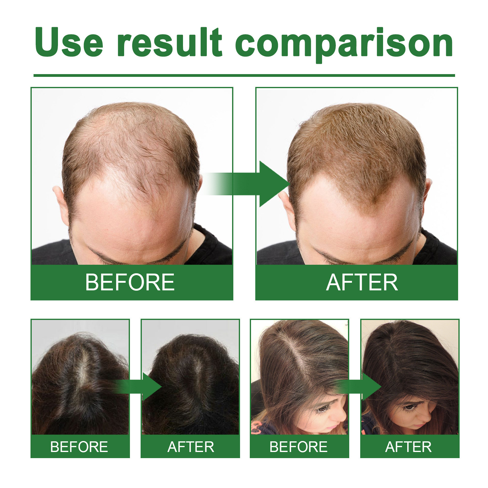 Rosemary Spray for Hair Nouris - Hair Care Herbal ulasan dan harga